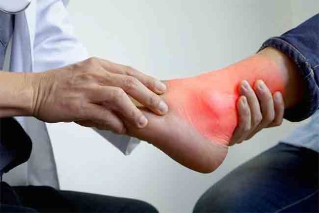 तुमच्या शरीरात युरिक अ‍ॅसिड तर वाढत नाहीये ना? दुर्लक्ष करू नका...