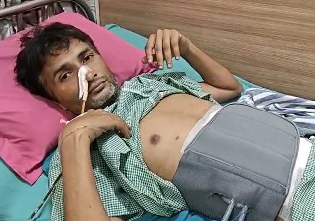 तरुणाचं ऑपरेशन, पोटातून काढल्या या वस्तू; डॉक्टर पण चक्रावले