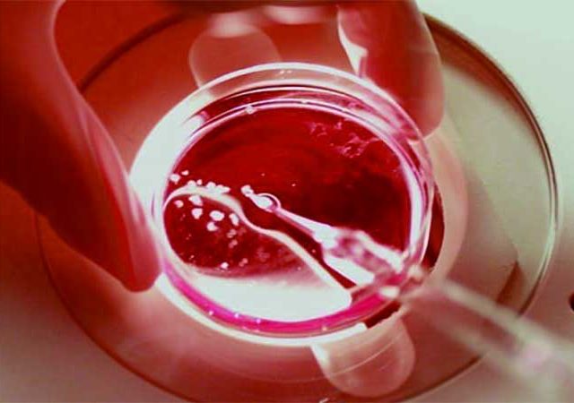 Egg Donation Case : तब्बल ३७ वेळा स्त्री बीज दान, बदलापूर प्रकरणी ५ हजार पानांचे आरोपपत्र ; १५ जणांवर गुन्हा