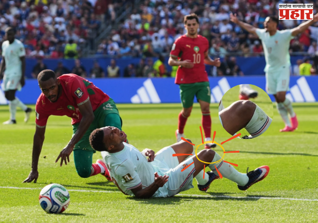 FIFA WORLDCUP 2026 : विश्वचषकात फ्रान्सचा विजय, पण किलियन एम्बाप्पेच्या दुखापतीने चाहत्यांची वाढली चिंता!