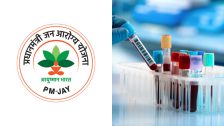 जन आरोग्य योजनेत महागड्या चाचणीचा समावेश, 63 उपचारांचा 'अतिरिक्त निदान प्रक्रिया' म्हणून योजनेत समावेश