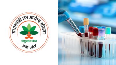 जन आरोग्य योजनेत महागड्या चाचणीचा समावेश, 63 उपचारांचा 'अतिरिक्त निदान प्रक्रिया' म्हणून योजनेत समावेश